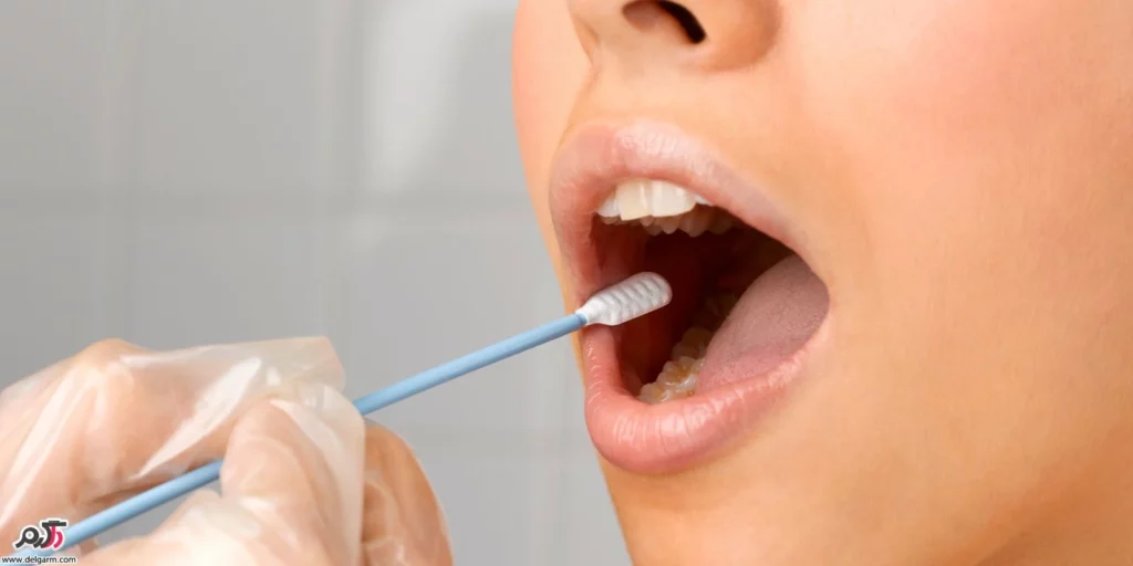 درمان تلخی دهان با مراقبت های بهداشتی