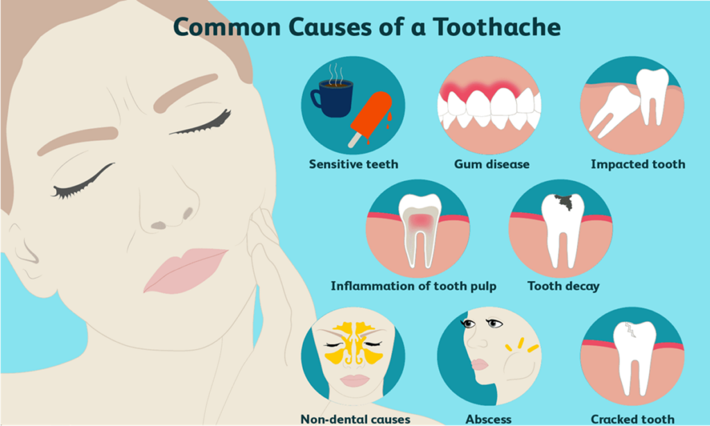 تصویری نشان دهنده دلایل ایجاد دندان درد